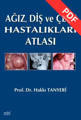 Ağız Diş ve Çene Hastalıkları Atlası