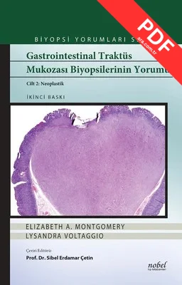 Biyopsi Yorumları Serisi-Gastrointestinal Traktüs Mukozası Biyopsilerinin Yorumu Cilt 2-Neoplastik