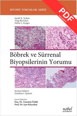 Böbrek ve Sürrenal Biyopsilerinin Yorumu