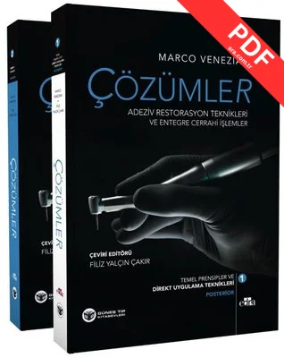 Çözümler Adeziv Restorasyon Teknikleri ve Entegre Cerrahi İşlemler 2 Cilt Takım