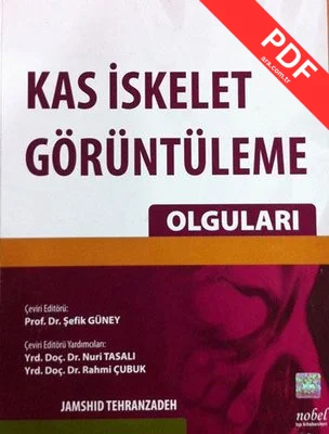 Kas İskelet Görüntüleme Olguları