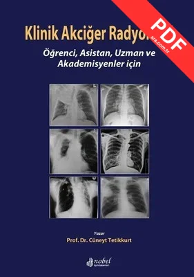 Klinik Akciğer Radyolojisi