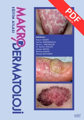 Makrodermatoloji Eğitim Atlası