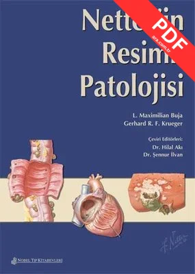 Netter'İn Resimli Patolojisi