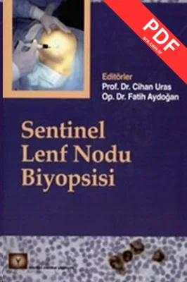 Sentinel Lenf Nodu Biyopsisi