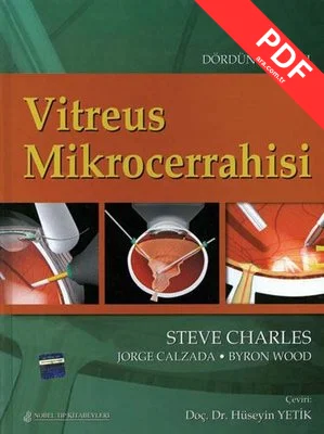 Vitreus Mikrocerrahisi